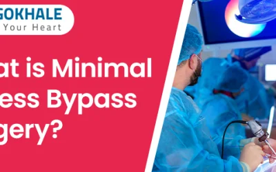 What is Minimal Access Bypass Surgery?